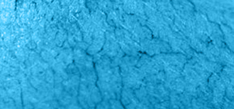 Blue_gef_chir
